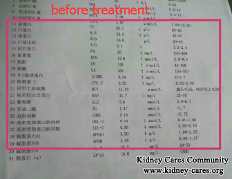 Toxin-Removing Treatment Treats Lupus Nephritis Effectively
