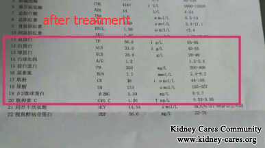 Toxin-Removing Treatment Treats Lupus Nephritis Effectively