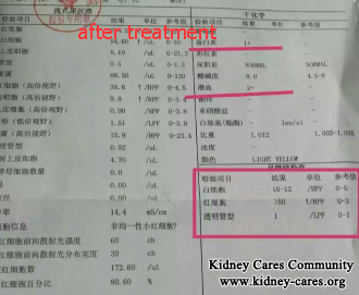 Toxin-Removing Treatment Treats Lupus Nephritis Effectively