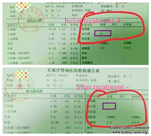 Cure Treatment Of Protein in Urine for IgA Nephropathy Patients