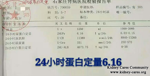 Nephrotic Syndrome, Proteinuria 6.16g Reduces To 1.89g