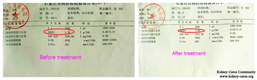 toxin-removing treatment for protein in urine, nephrotic syndrome treatment 