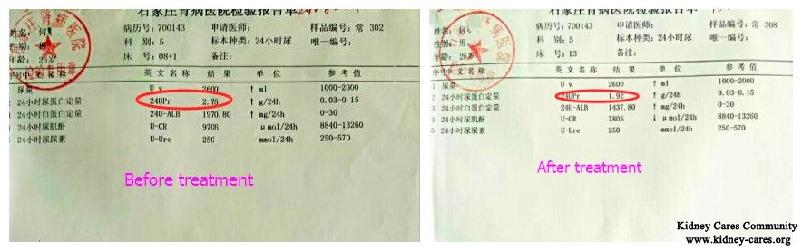 toxin-removing treatment for protein in urine, nephrotic syndrome treatment 