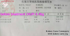 24UPr Proteinuria Is Reduced To 2.48g from 6.46g After 10 Days Chinese Medicine Treatment