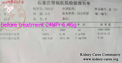 treatment for proteinuria in Nephrotic Syndrome 