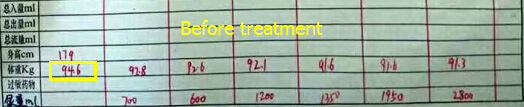 Pitting Edema Gets Well Controlled with Toxin-Removing Treatment