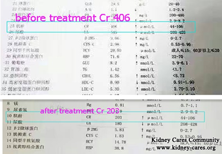 It Is Possible To Lower High Creatinine 406 to 203umol/L Without Dialysis