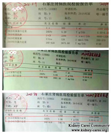 nephrotic syndrome treatment,Toxin-Removing Treatment for nehrotic syndrome,treatment for proteinuria in nephrotic syndrome 