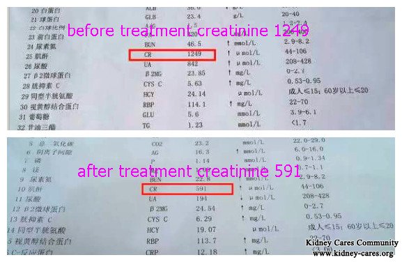 High Serum Creatinine Reduced From 1249 to 591 Within 10 Days