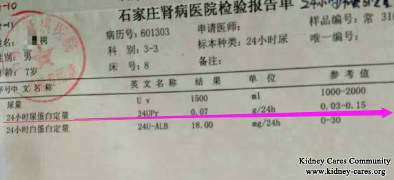   Nephrotic Syndrome: Proteinuria 5.71g Is Reduced To 0.07g