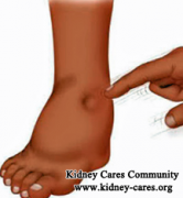 Swelling In Kidney Failure: What Should Be Best Treatment