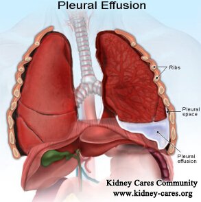 Treatment of Pleural Effusion in Dialysis Patients
