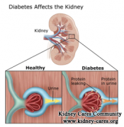 How to Treat Hypoproteinemia Due to Diabetic Nephropathy