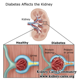  Treat Hypoproteinemia Due to Diabetic Nephropathy