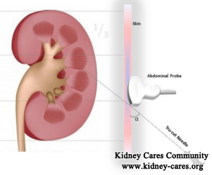 Is Renal Biopsy Suitable For All CKD Patients