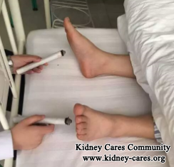 Four One Chinese Medicine Treatment For Uremia