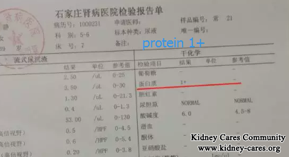 I Get A Good Improvement With Glomerulonephritis In This Hospital