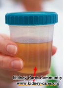 Is Blood In Urine Common For Dialysis Patients