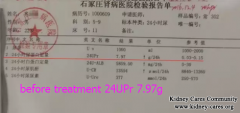 Why Does Your Membranous Nephropathy Become Worse