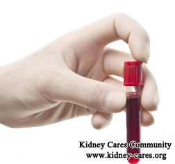 Alternative treatment for high creatinine level 8.5