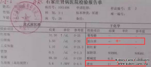 Lupus Nephritis Treatment In Our Hospital