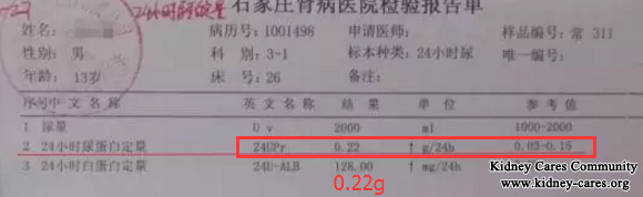 Lupus Nephritis Treatment In Our Hospital