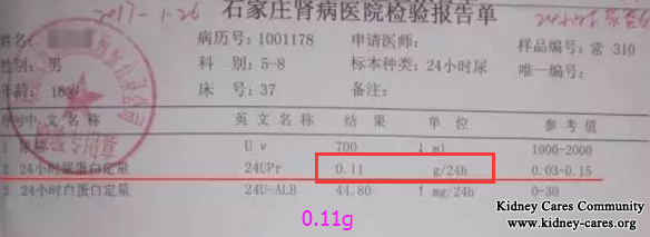 Treatment for Lupus Nephritis In Our Hospital 