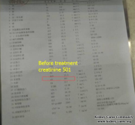 Chinese Medicine Treatments Make Diabetic Nephropathy Patients Regain New Life