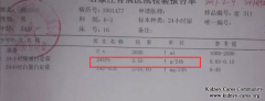 Membranous Nephropathy Protein 3+ Is Reduced By Chinese Medicines