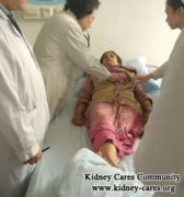 No Dialysis for Diabetics With High Creatinine Level 5