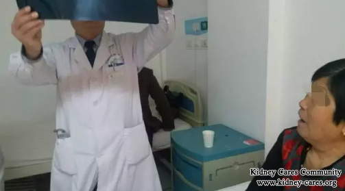 Treatment for Proteinuria and Swelling In Nephritis 