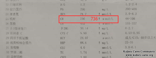 High Creatinine Level 736umol/L Is Reduced To 453umol/L