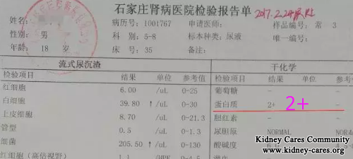 Protein 2+ Become Negative In Nephrotic Syndrome