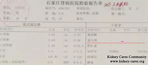 Protein 2+ Become Negative In Nephrotic Syndrome