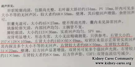 Kidney Cysts In PKD Become Smaller After Chinese Medicine Treatments