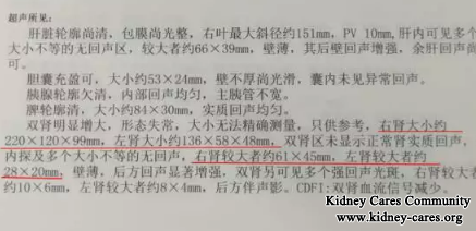 Kidney Cysts In PKD Become Smaller After Chinese Medicine Treatments