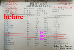 How To Reduce High Creatinine Level 1084 In Kidney Failure Effectively