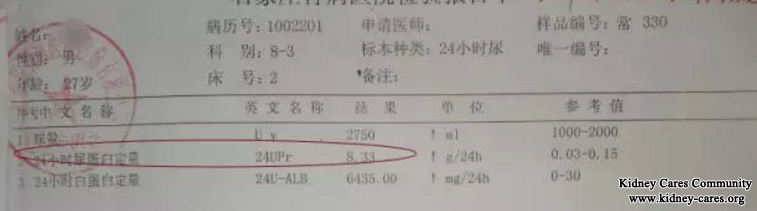 Proteinuria Increases To 21g from 3g Due to Wrong Medicine