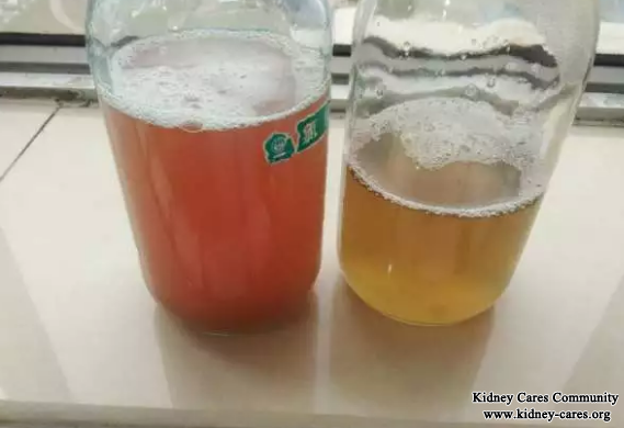 Chinese Medicine Treatment for Hematuria And High Creatinine Level