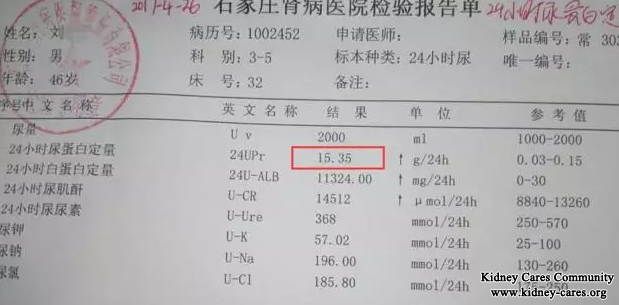 Primary Membranous Nephropathy, Body Weight Reduces 15kg After 15 Days Treatment