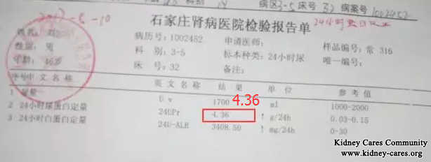 Primary Membranous Nephropathy, Body Weight Reduces 15kg After 15 Days Treatment