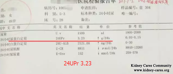 Will Lupus Nephritis Develop To Uremia