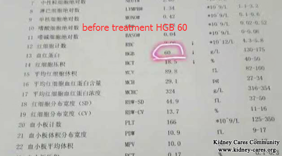 High Creatinine Level Is Reduced In Just 10 Days