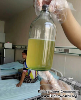 Foamy Urine Disappears Naturally In Nephritis Patients