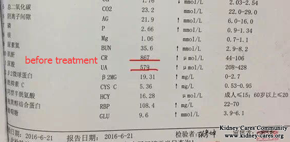 Toxin-Removing Treatment Lowers High Uric Acid Level In Kidney Patients