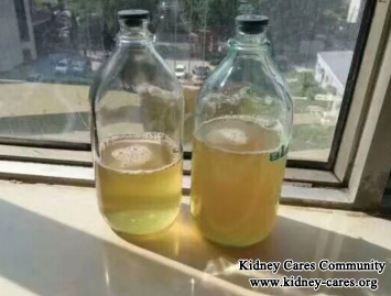 Blood In Urine Disappears In Nephritis With Toxin-Removing Treatment