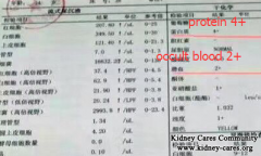 Do You Treat Your Nephrotic Syndrome Correctly