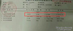 Characteristic Chinese Medicine Treats Proteinuria Effectively