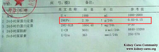Proteinuria And Hematuria In IgA Nephropathy Is Reduced In Our Hospital