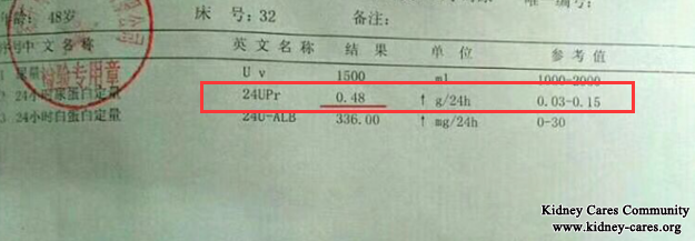 Proteinuria And Hematuria In IgA Nephropathy Is Reduced In Our Hospital